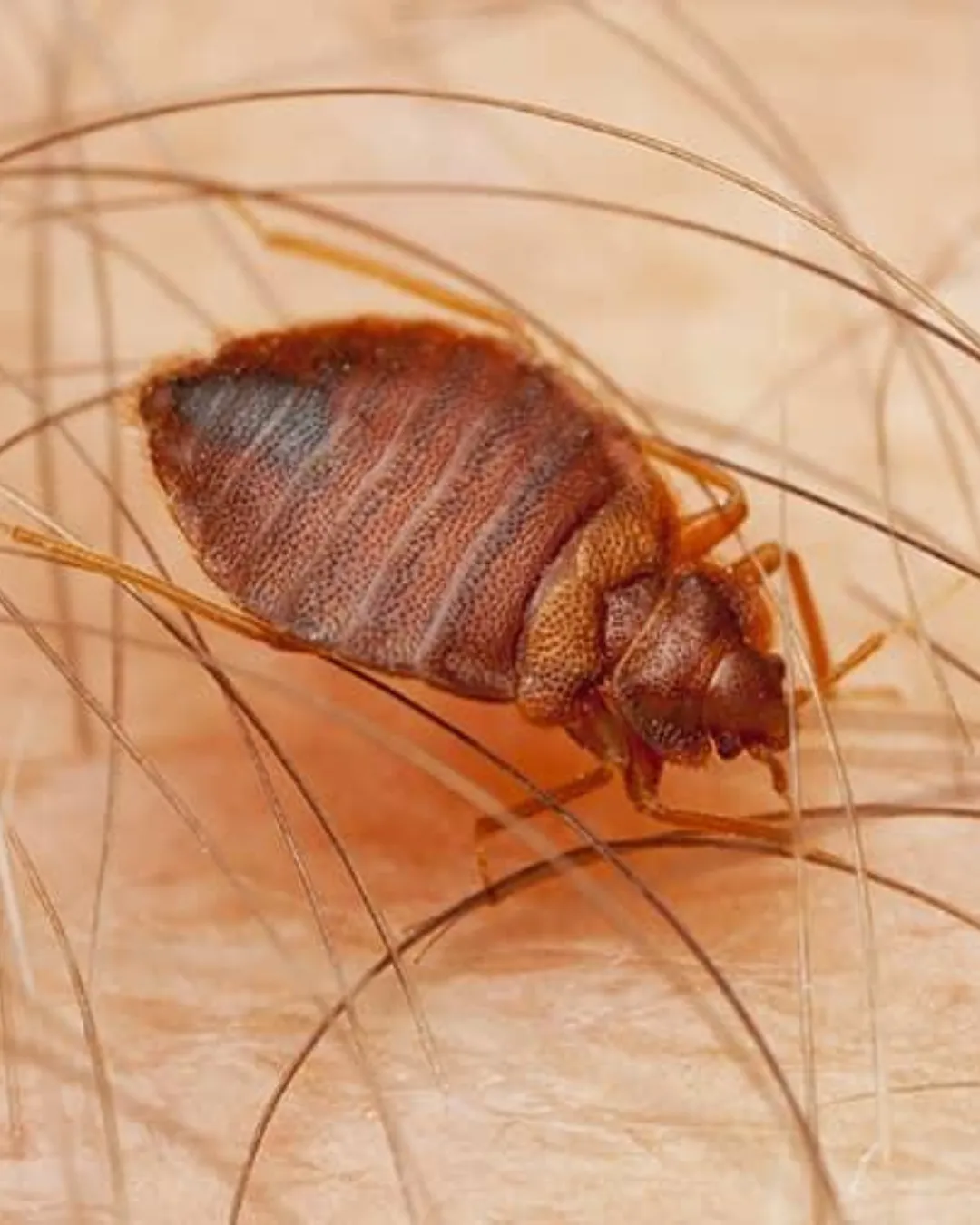 Bedbug Extermination Services
